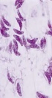 Prevalence of Anti-<i>Toxoplasma gondii</i> Antibodies in Young Iranians: The CASPIAN III Study